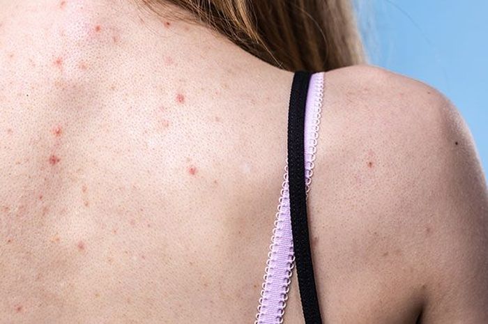 10 Cara Sederhana Terbukti Berhasil